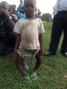 This is Trevor when we found him at a bus stop in Uganda. We have started treatment to straighten his legs.