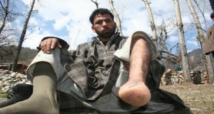 Afghanistan Landmine victim