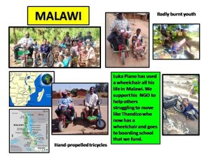 MENDNZ Helping Patients in Malawi